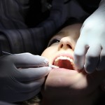 虫歯治療をする女性